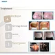 diode combo treatment machine